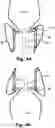 Fig. 05 - Medical system, a device for collecting chordae and/or leaflets and a method therefor