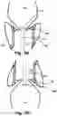 Fig. 06 - Medical system, a device for collecting chordae and/or leaflets and a method therefor