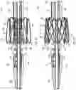 Fig. 09 - PROSTHETIC HEART VALVE DELIVERY SYSTEM