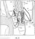 Fig. 12 - PROSTHETIC HEART VALVE DELIVERY SYSTEM