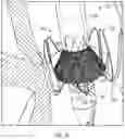 Fig. 14 - PROSTHETIC HEART VALVE DELIVERY SYSTEM