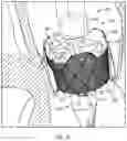 Fig. 15 - PROSTHETIC HEART VALVE DELIVERY SYSTEM