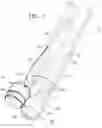 Fig. 02 - Annuloplasty technologies