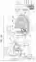 Fig. 04 - Annuloplasty technologies