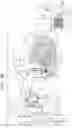 Fig. 05 - Annuloplasty technologies
