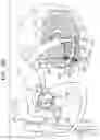 Fig. 07 - Annuloplasty technologies