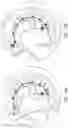 Fig. 13 - Annuloplasty technologies