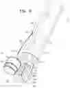 Fig. 17 - Annuloplasty technologies