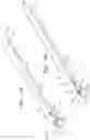 Fig. 26 - Annuloplasty technologies