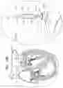 Fig. 30 - Annuloplasty technologies