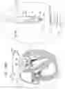 Fig. 36 - Annuloplasty technologies