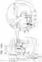 Fig. 37 - Annuloplasty technologies