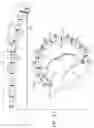Fig. 43 - Annuloplasty technologies
