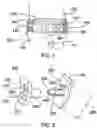 Fig. 02 - System and method for installing an annular repair rivet through a vertebral body port