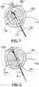 Fig. 06 - System and method for installing an annular repair rivet through a vertebral body port