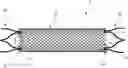 Fig. 01 - BRAIDED STENT SYSTEM WITH ONE OR MORE EXPANSION RINGS