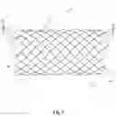 Fig. 08 - BRAIDED STENT SYSTEM WITH ONE OR MORE EXPANSION RINGS