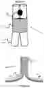 Fig. 04 - Vessel Prosthesis
