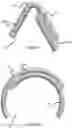Fig. 05 - Vessel Prosthesis