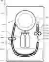 Fig. 01 - Automatically deployable intravascular device system