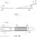 Fig. 02 - Stent retention