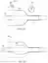 Fig. 05 - Stent retention