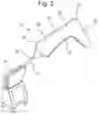 Fig. 03 - Orthosis