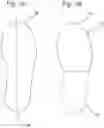 Fig. 04 - Orthosis