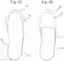 Fig. 05 - Orthosis