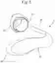 Fig. 08 - Orthosis