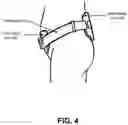 Fig. 06 - Forward bending support brace
