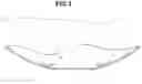Fig. 03 - Method of providing an ostomy device that is shape-adjustable to conform to a bulge or a hernia associated with a stoma