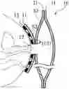 Fig. 01 - Body fluid collection device