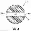 Fig. 05 - Selectively moveable valve elements for aspiration and irrigation circuits