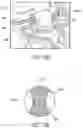 Fig. 15 - Selectively moveable valve elements for aspiration and irrigation circuits