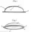Fig. 02 - Dome Bandage