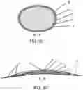 Fig. 04 - Compound (multi-layer) waterproof bandage