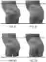 Fig. 16 - Beamed elastomeric laminate performance and zones
