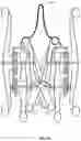 Fig. 28 - WHEELCHAIR PROPULSION ASSISTANCE DEVICES AND SYSTEMS