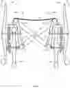 Fig. 29 - WHEELCHAIR PROPULSION ASSISTANCE DEVICES AND SYSTEMS