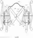 Fig. 30 - WHEELCHAIR PROPULSION ASSISTANCE DEVICES AND SYSTEMS