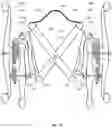 Fig. 34 - WHEELCHAIR PROPULSION ASSISTANCE DEVICES AND SYSTEMS