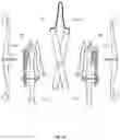 Fig. 36 - WHEELCHAIR PROPULSION ASSISTANCE DEVICES AND SYSTEMS