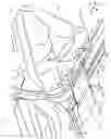 Fig. 10 - Wheelchair