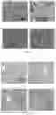 Fig. 07 - Use of fumaric acid esters and pharmaceutically acceptable salts thereof in preparing pharmaceuticals for treating ferroptosis-related diseases