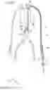 Fig. 02 - Catheter and method of engaging catheter