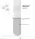 Fig. 02 - Process for interfacial separation of metal nanoparticles or nanowires using centrifugal separators