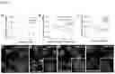 Fig. 04 - Compositions and methods for impeding transcription of expanded microsatellite repeats