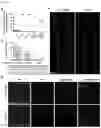 Fig. 12 - Compositions and methods for impeding transcription of expanded microsatellite repeats