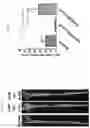 Fig. 04 - GENE THERAPY FOR TREATING FAMILIAL HYPERCHOLESTEROLEMIA